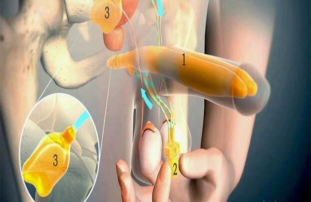Lipofilācijas operācija